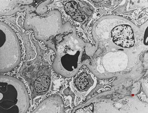 M,34y. | normal kidney M,34y. | normal kidney